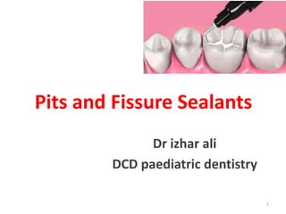 Pits and Fissure Sealants
Dr izhar ali
DCD paediatric dentistry
1
 