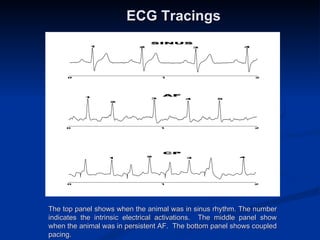 ECG Tracings   The top panel shows when the animal was in sinus rhythm. The number indicates the intrinsic electrical activations.  The middle panel show when the animal was in persistent AF.  The bottom panel shows coupled pacing. 