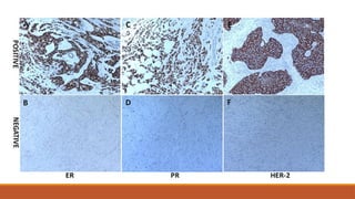 Pathology specimen handling and process of making slides | PPTX