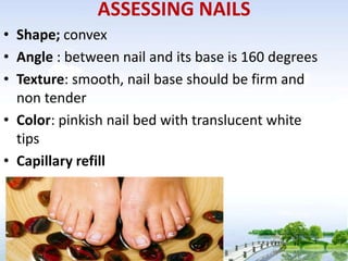 ABNORMALITIES OF NAIL
•   Koilonychias (spoon nail)
•    clubbing
•   Paranychia
•   indentations called (beau’s line)
 