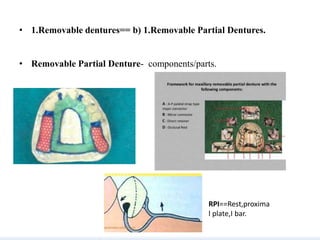 Rpcvs Rpi Dentures Ppt for spotters | PPTX