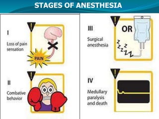 STAGES OF ANESTHESIA
 