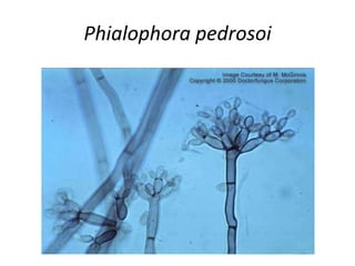 Phialophora pedrosoi
 