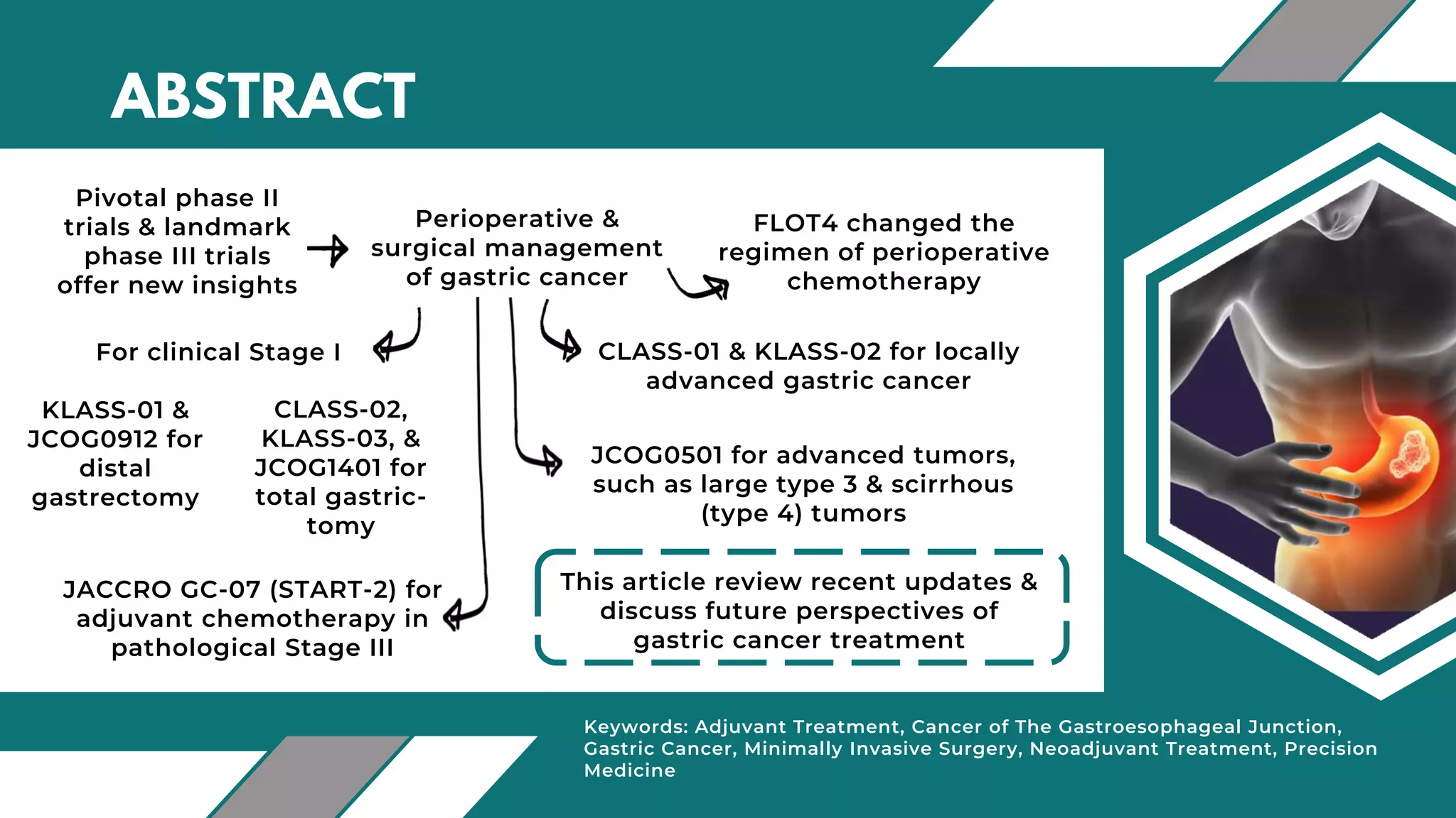 PPT Gastric Cancer.pptx