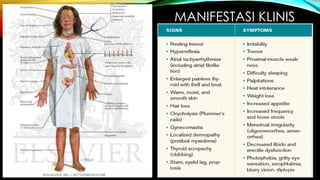 MANIFESTASI KLINIS
September 19, 2013
 