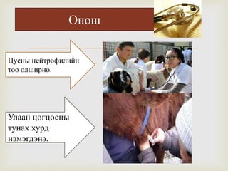 
Цусны нейтрофилийн
тоо олширно.
Улаан цогцосны
тунах хурд
нэмэгдэнэ.
Онош
 