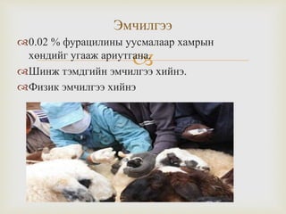 
0.02 % фурацилины уусмалаар хамрын
хөндийг угааж ариутгана.
Шинж тэмдгийн эмчилгээ хийнэ.
Физик эмчилгээ хийнэ
Эмчилгээ
 