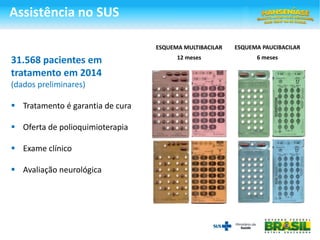 Assistência no SUS
31.568 pacientes em
tratamento em 2014
(dados preliminares)
 Tratamento é garantia de cura
 Oferta de polioquimioterapia
 Exame clínico
 Avaliação neurológica
ESQUEMA MULTIBACILAR
12 meses
ESQUEMA PAUCIBACILAR
6 meses
 