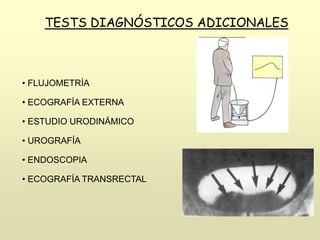 TESTS DIAGNÓSTICOS ADICIONALES
• FLUJOMETRÍA
• ECOGRAFÍA EXTERNA
• ESTUDIO URODINÁMICO
• UROGRAFÍA
• ENDOSCOPIA
• ECOGRAFÍA TRANSRECTAL
 