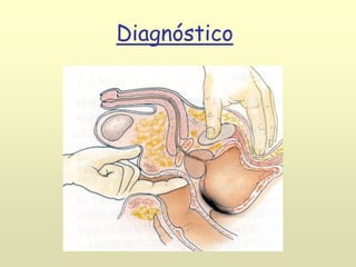 Diagnóstico
 