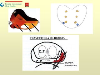 Madrid
Hospital Universitario
12 de Octubre
 