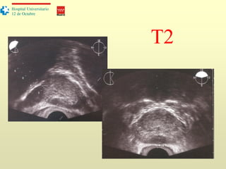 Madrid
Hospital Universitario
12 de Octubre
T2
 