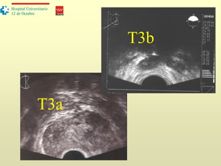 T3a
Madrid
Hospital Universitario
12 de Octubre
T3b
 