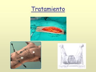 Tratamiento
f
o
t
o
d
e
l
a
p
a
r
o
t
o
m
í
a
m
e
d
i
a
i
n
f
r
a
u
m
b
i
l
i
c
a
l
 