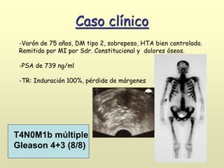 Caso clínico
-Varón de 75 años, DM tipo 2, sobrepeso, HTA bien controlado.
Remitido por MI por Sdr. Constitucional y dolores óseos.
-PSA de 739 ng/ml
-TR: Induración 100%, pérdida de márgenes
T4N0M1b múltiple
Gleason 4+3 (8/8)
 