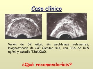 Varón de 59 años, sin problemas relevantes.
Diagnosticado de CaP Gleason 4+4, con PSA de 16.5
ng/ml y estadio T3aN0M0.
¿Qué recomendaríais?
Caso clínico
 