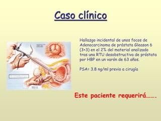 Caso clínico
Hallazgo incidental de unos focos de
Adenocarcinoma de próstata Gleason 6
(3+3) en el 2% del material analizado
tras una RTU desobstructiva de próstata
por HBP en un varón de 63 años.
PSA= 3.8 ng/ml previo a cirugía
Este paciente requerirá…….
 