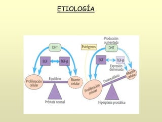 ETIOLOGÍA
 