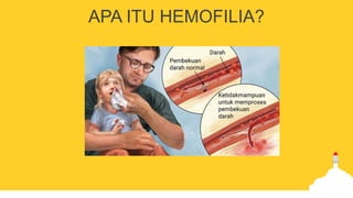 APA ITU HEMOFILIA?
 