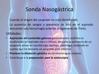 Sonda Nasogástrica
Cuando el origen del sangrado no está identificado.
La ausencia de sangre y presencia de bilis en el aspirado
descartan una hemorragia anterior al ligamento de Treitz.
Utilidades:
• Aspiración del contenido gástrico generalmente confirma la
localización (el aspirado claro o bilioso, descarta la existencia de un
sangrado activo en nasofaringe, esófago, estómago, teniendo en
cuenta que no descarta un sangrado post-pilórico)
• Previene la dilatación gástrica en las hemorragias masivas
• Contribuye a la preparación para la endoscopia
 
