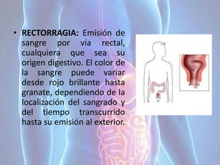 • RECTORRAGIA: Emisión de
sangre por vía rectal,
cualquiera que sea su
origen digestivo. El color de
la sangre puede variar
desde rojo brillante hasta
granate, dependiendo de la
localización del sangrado y
del tiempo transcurrido
hasta su emisión al exterior.
 