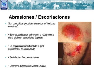 Heridas y Hemorragias | PPTX