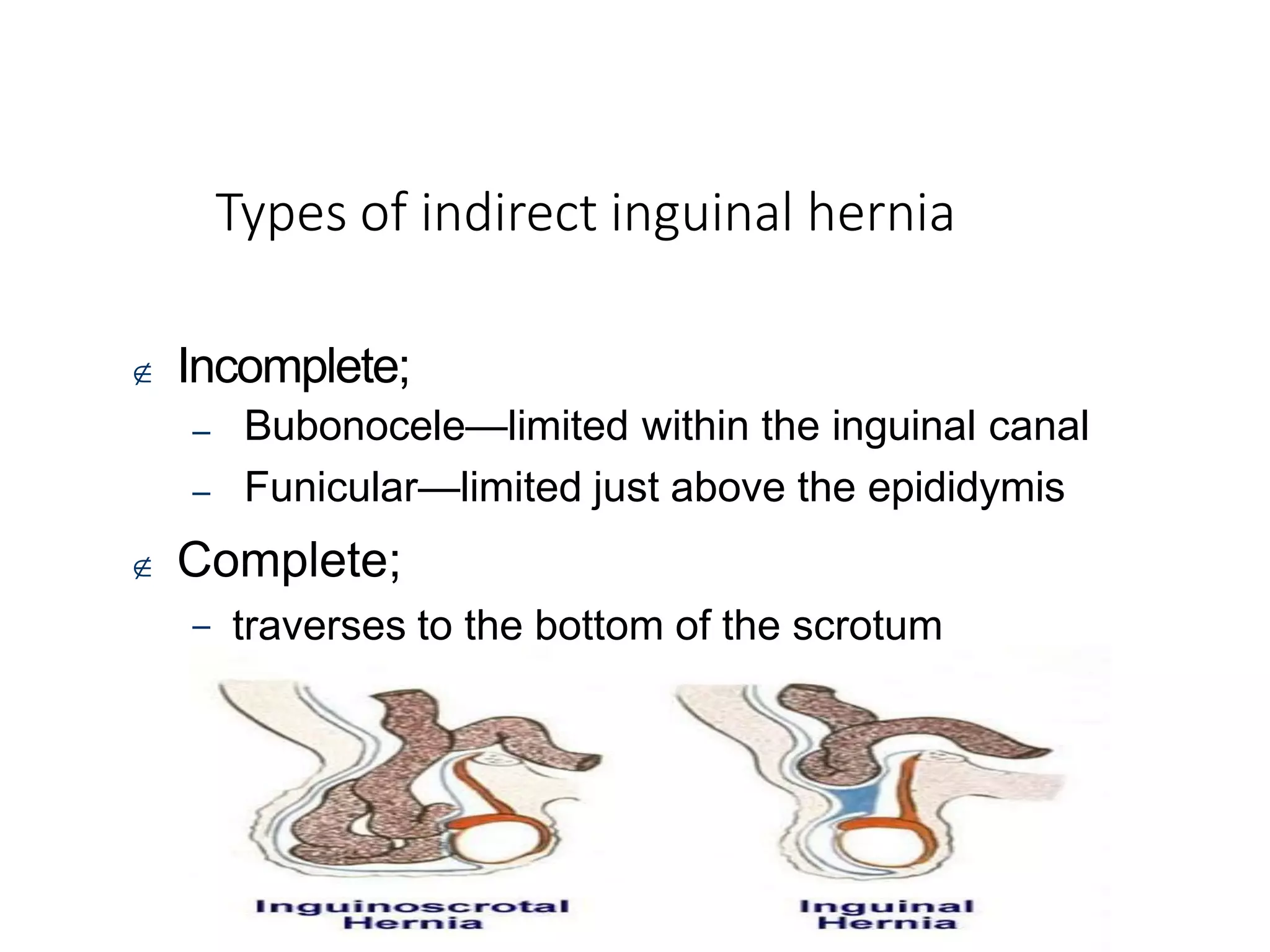 Ppt Hernia Pdf