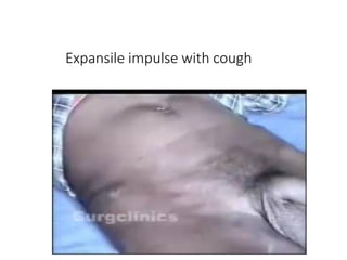 Expansile impulse with cough
University of Alexandria
 