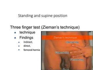 Standing and supine position
University of Alexandria
Three finger test (Zieman’s technique)





technique
Findings
Indirect,
direct,
femoral hernia
 