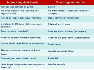 University of
Alexandria
Indirect inguinal hernia Direct inguinal hernia
Elderly
Via transversalis fascia (hasselbach’s
triangle)
Weak abdominal wall/muscle
Bilateral in > ½ case
Does not enter scrotum (incomplete)
Reduced on lying down (automatically)
Broad neck
Impulse on middle finger
Bulge out
Any age but common in young
Via deep inguinal ring and long the
inguinal canal
Patent or reopen processus vaginalis
Unilateral in 2/3 case (right side more
common)
Enter scrotum (complete)
Reduced by patient/doctor (manually)
Narrow neck- more liable to strangulate
Zieman technique- impulse on index
finger
Deep ring occlusion test- control
Little finger invagination test- impulse on
finger tip
Impulse on pulp
 