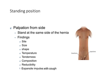 Standing position
University of Alexandria
 Palpation from side
– Stand at the same side of the hernia
– Findings
 Site
 Size
 shape
 Temperature
 Tenderness
 Composition
 Reducibility
 Expansile impulse with cough
 