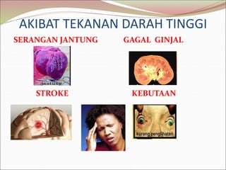 AKIBAT TEKANAN DARAH TINGGI
SERANGAN JANTUNG GAGAL GINJAL
STROKE KEBUTAAN
 