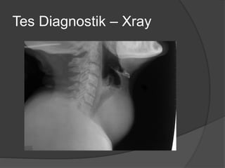 Tes Diagnostik – Xray
 