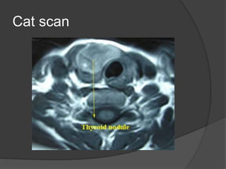 Cat scan
 