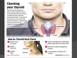 Ppt hipotiroid dan hipertiroid