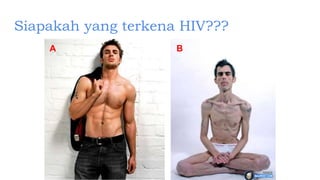 Siapakah yang terkena HIV???
A B
 