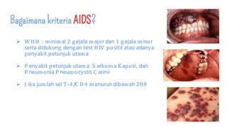 Bagaimana kriteria AIDS?
 W HO : minimal 2 gejala major dan 1 gejala minor
serta didukung dengan test HIV positif atau adanya
penyakit petunjuk utama
 P enyakit petunjuk utama: S arkoma Kaposi, dan
P neumonia P neumocystis C arinii
 J ika jumlah sel T-4/C D 4 menurun dibawah 200
 