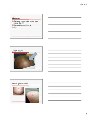 1/23/2011 
8 
Ida.doc/maternity 22 
Abdomen 
 Periksa: bekas luka, striae, linea 
nigra, BU, KK 
 Periksa Leopold I sd IV 
 DJJ 
LINEA NIGRA 
23 
Striae gravidarum 
 