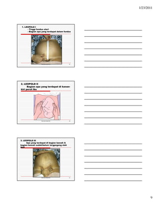 1/23/2011 
9 
Ida.doc/maternity 25 
1. LEOPOLD I 
- Tinggi fundus uteri 
- Bagian apa yang terdapat dalam fundus 
Ida.doc/maternity 26 
2. LEOPOLD II 
Bagian apa yang terdapat di kanan-kiri 
perut ibu 
Ida.doc/maternity 27 
3. LEOPOLD III 
Apa yang terdapat di bagian bawah  
bagian bawah sudah/belum tergpegang oleh 
PAP 
 