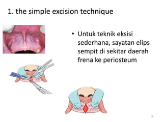 Ppt ikga2 pdf | PDF