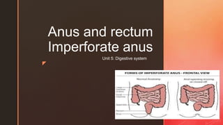 ◤
Anus and rectum
Imperforate anus
Unit 5: Digestive system
 