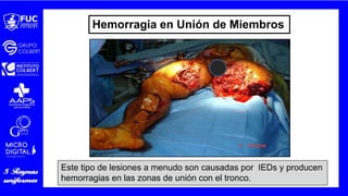 Hemorragia en Unión de Miembros
Este tipo de lesiones a menudo son causadas por IEDs y producen
hemorragias en las zonas de unión con el tronco.
 
