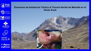 Escenario de Asistencia Táctica al Trauma Herida de Metralla en el
Hindu Kush
 