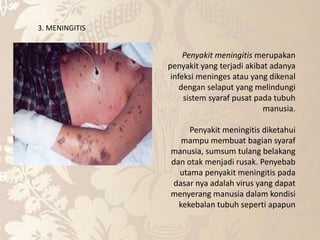 3. MENINGITIS
Penyakit meningitis merupakan
penyakit yang terjadi akibat adanya
infeksi meninges atau yang dikenal
dengan selaput yang melindungi
sistem syaraf pusat pada tubuh
manusia.
Penyakit meningitis diketahui
mampu membuat bagian syaraf
manusia, sumsum tulang belakang
dan otak menjadi rusak. Penyebab
utama penyakit meningitis pada
dasar nya adalah virus yang dapat
menyerang manusia dalam kondisi
kekebalan tubuh seperti apapun
 