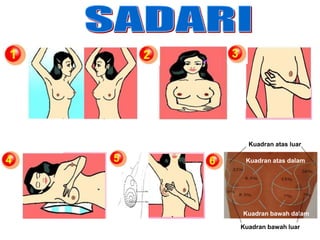 Kuadran atas dalam
Kuadran atas luar
Kuadran bawah luar
Kuadran bawah dalam
 