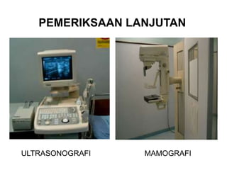 PEMERIKSAAN LANJUTAN
ULTRASONOGRAFI MAMOGRAFI
 