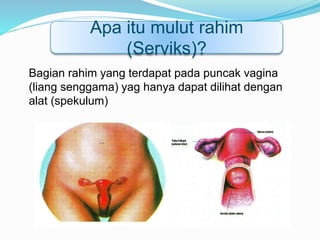 Bagian rahim yang terdapat pada puncak vagina
(liang senggama) yag hanya dapat dilihat dengan
alat (spekulum)
Apa itu mulut rahim
(Serviks)?
 