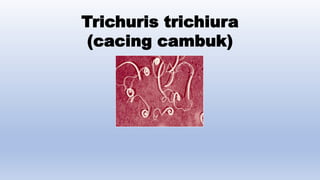 Trichuris trichiura
(cacing cambuk)
 