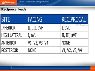 Reciprocal leads
 