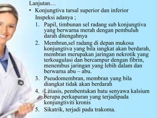 Lanjutan…
• Konjungtiva tarsal superior dan inferior
Inspeksi adanya ;
1. Papil, timbunan sel radang sub konjungtiva
yang berwarna merah dengan pembuluh
darah ditengahnya
2. Membran,sel radang di depan mukosa
konjungtiva yang bila iangkat akan berdarah,
membran merupakan jaringan nekrotik yang
terkoagulasi dan bercampur dengan fibrin,
menembus jaringan yang lebih dalam dan
berwarna abu – abu.
3. Pseudomembran, membran yang bila
diangkat tidak akan berdarah
4. Litiasis, pembentukan batu senyawa kalsium
berupa perkapuran yang terjadipada
konjungtiviti kronis
5. Sikatrik, terjadi pada trakoma.
 